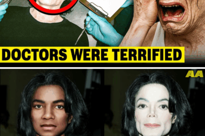 Michael Jackson’s Autopsy Exposes The Terrifying Truth He Tried To Hide Behind His Plastic Surgeries