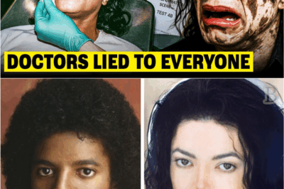 How Michael Jackson’s Health Battles, Including Vitiligo, Contributed to His Tragic Death