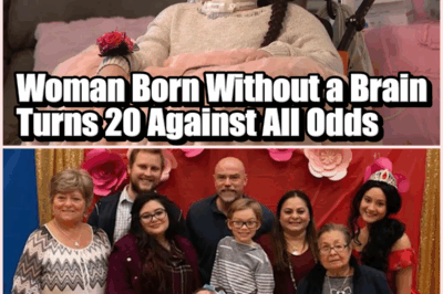 Woman Born Without a Brain Turns 20 Against All Odds — “She’s a Fighter,” Her Family Says